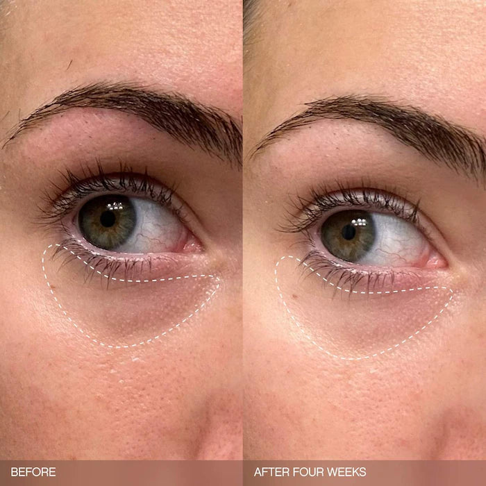 Topicals Faded Brightening Bundle