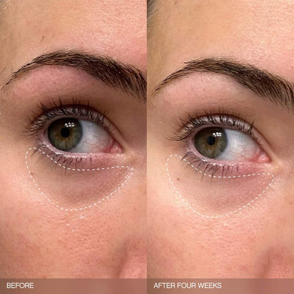 Topicals Faded Brightening Bundle