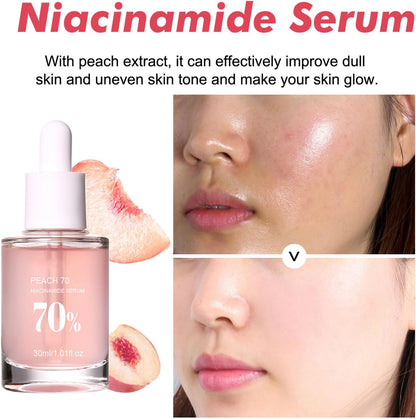 Sample Anua Peach 70 Niacin Serum