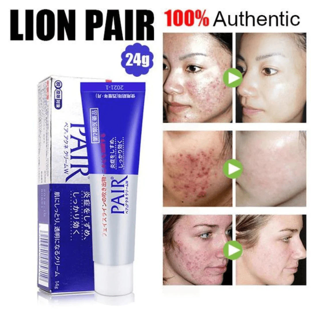 Pair Acne Cream (24g)