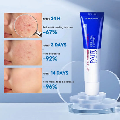 Pair Acne Cream (24g)