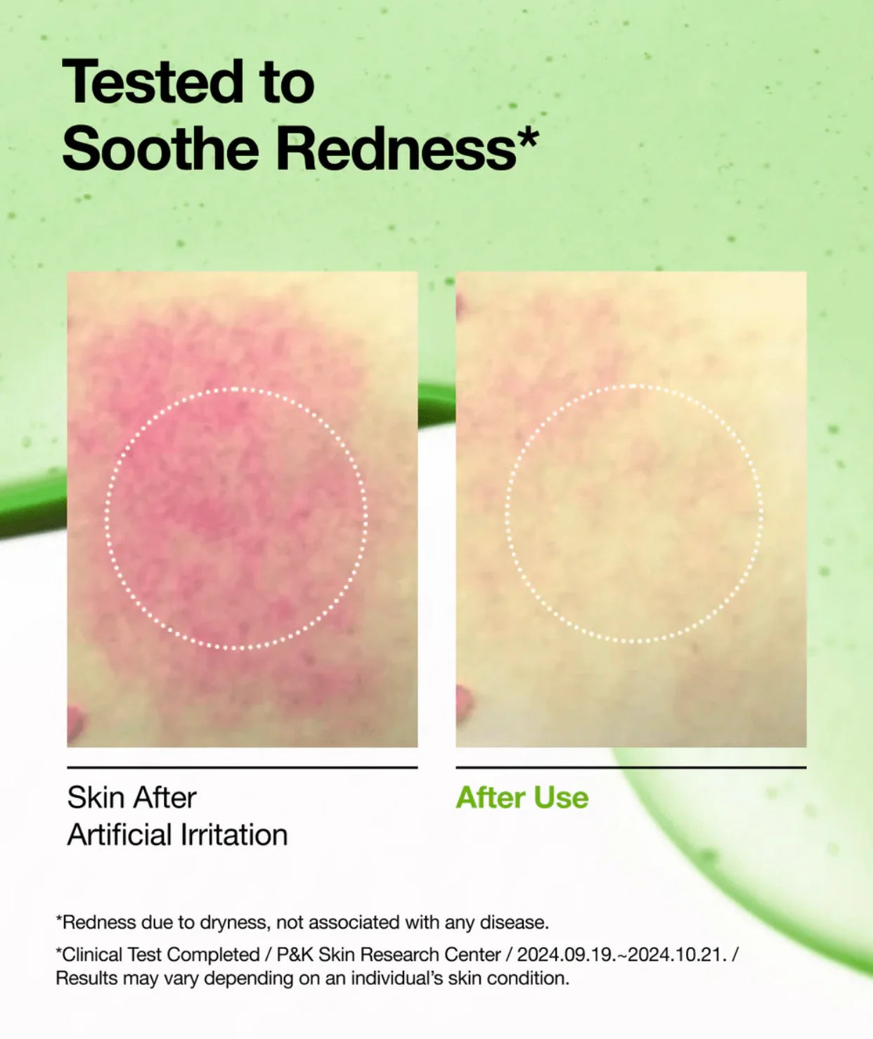 Sample ANUA Azelaic Acid 15 Intense Calming Serum