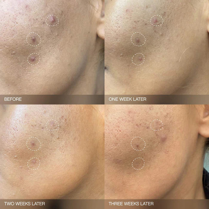 Topicals Faded Brightening Bundle